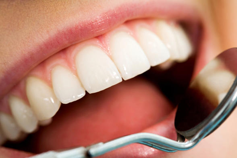 Bleeding Gums? Periodontal Disease