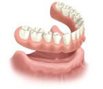 Removable full denture